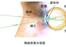 眼睛成像示意图