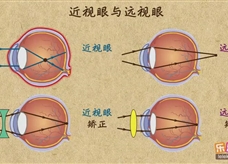 “乐乐课堂”初中物理教学视频素材：《透镜及其应用》14近视眼与远视眼