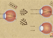 “乐乐课堂”初中物理教学视频素材：《透镜及其应用》15眼镜的度数